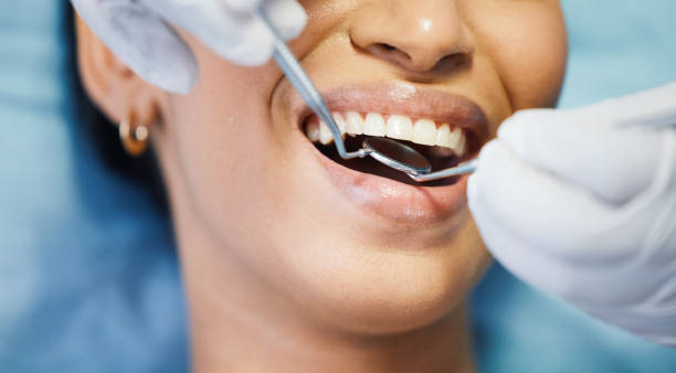 Best Same-Day Emergency Dental Services in Santa Rosa Valley, CA