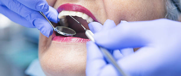 Best Emergency Dental Care for Broken or Chipped Teeth in Santa Rosa Valley, CA